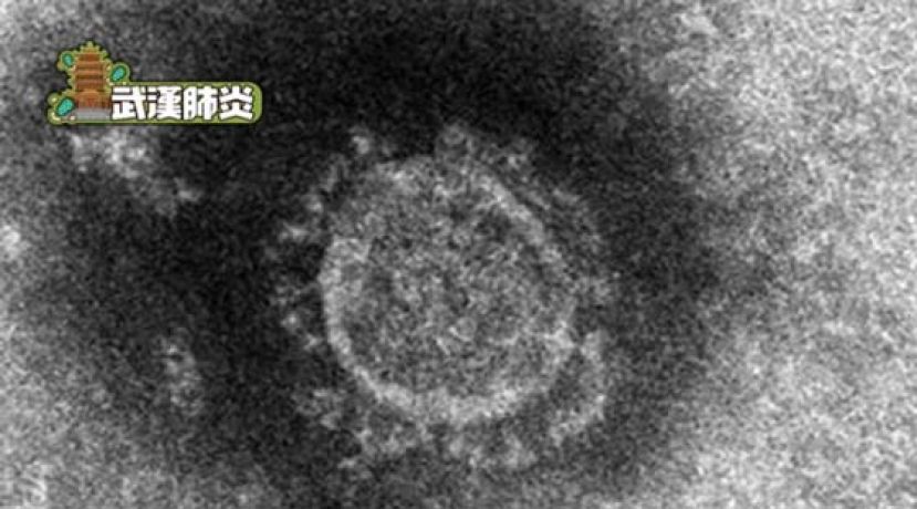 基因或令亚洲人死亡率较低　日本研究患者基因与症状关系