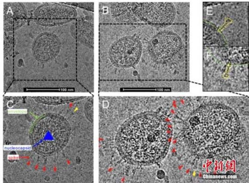 资料图：深圳科研团队首次描绘灭活新冠病毒的真实形貌。