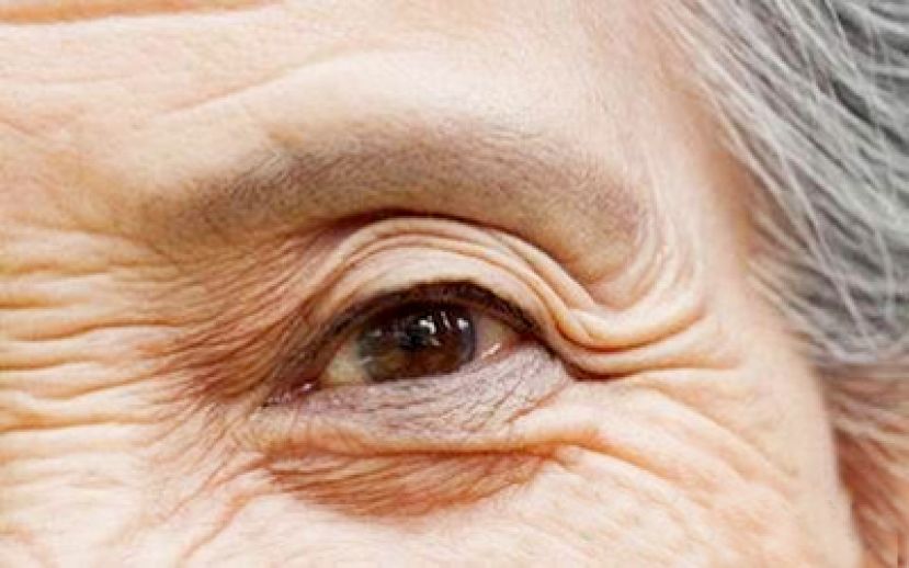 疼惜妈妈白内障 可变色人工水晶体来护眼