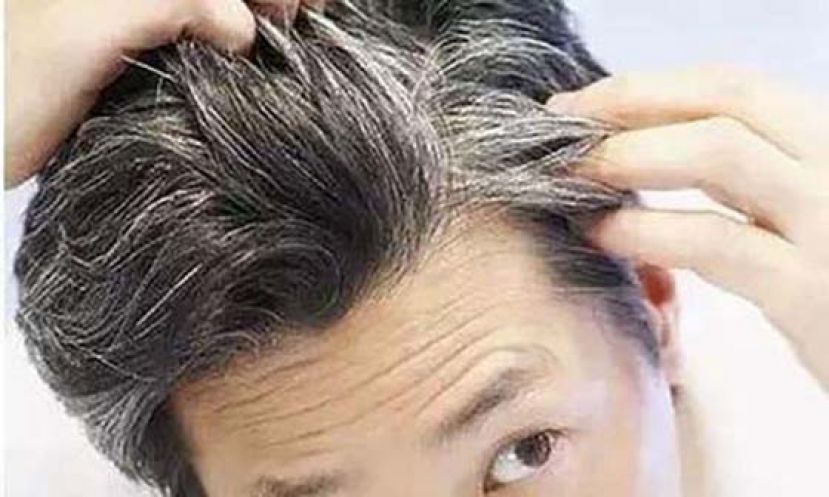 熬夜、过度用脑猛冒白发？ 医：吃 &ldquo;这类食物&rdquo; 补肾顾发