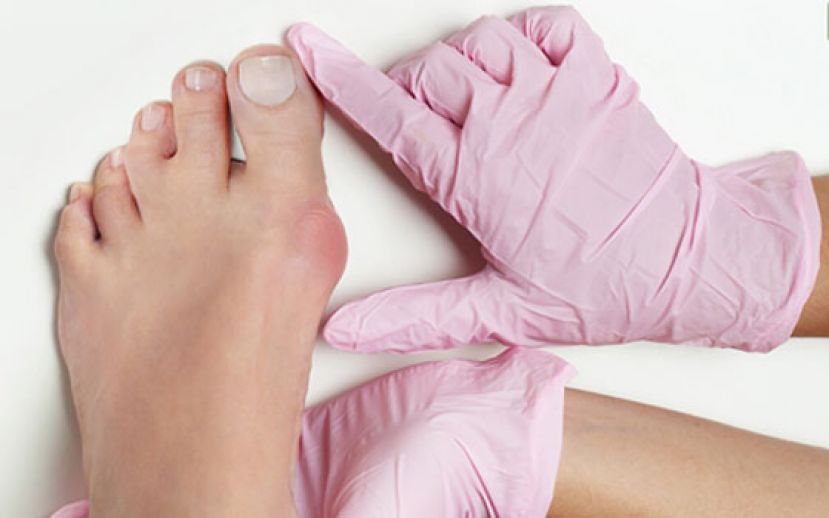 肩膀酸、偏头痛&hellip;竟是因 &ldquo;拇趾外翻&rdquo; 造成？ 医教 &ldquo;1招&rdquo; 自我检测