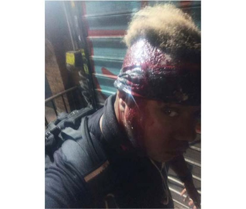 瓦伦丁的头部受到严重损伤。