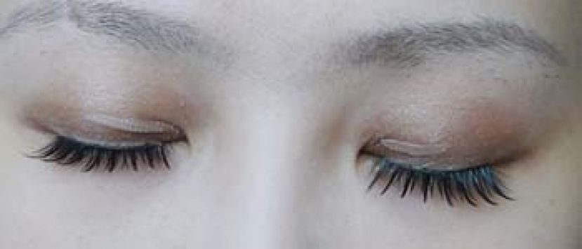 使用双眼皮贴 小心材质易过敏