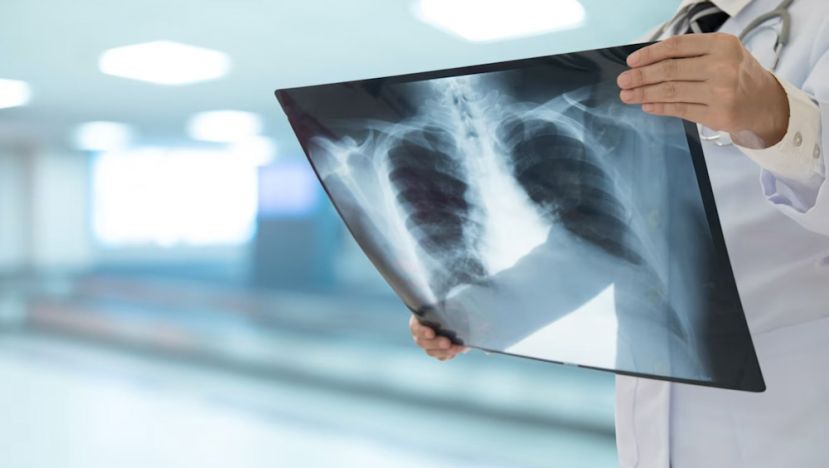 卫长：今年截至2月7日  国内通报10个新的肺结核感染群