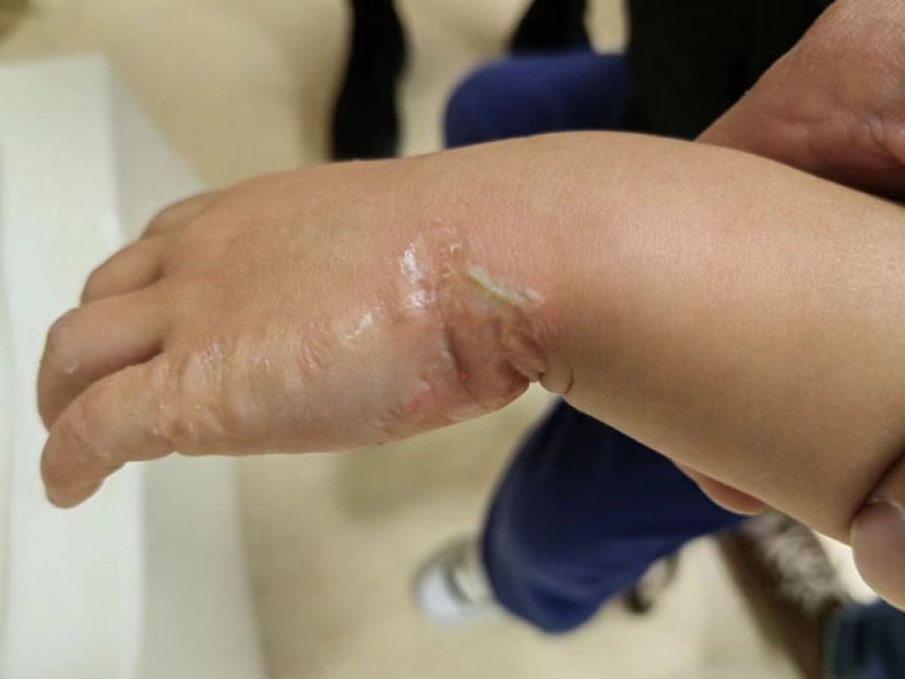 盘点居家4大危险场域＋急救步骤