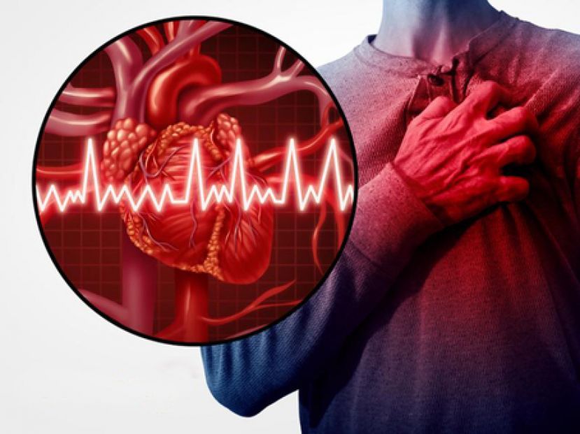 血管阻塞并严重钙化　旋磨术助放支架