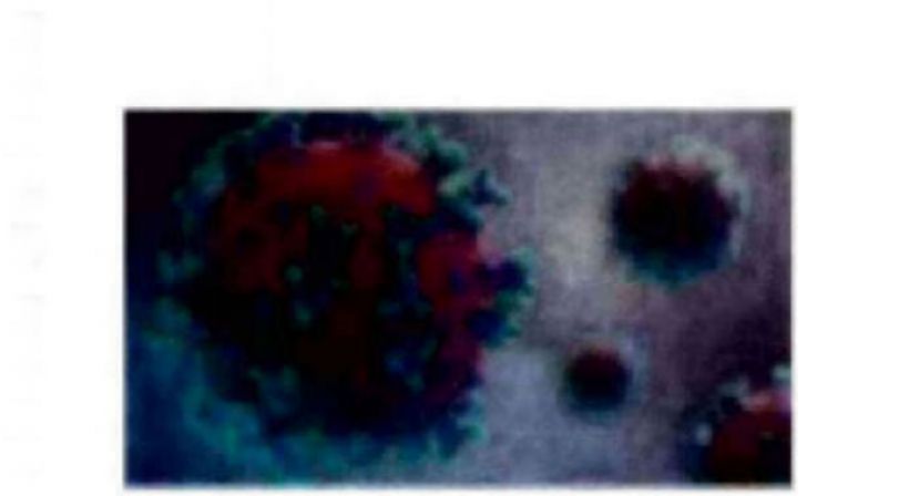 《新冠肺炎》大马新增4503确诊10病逝