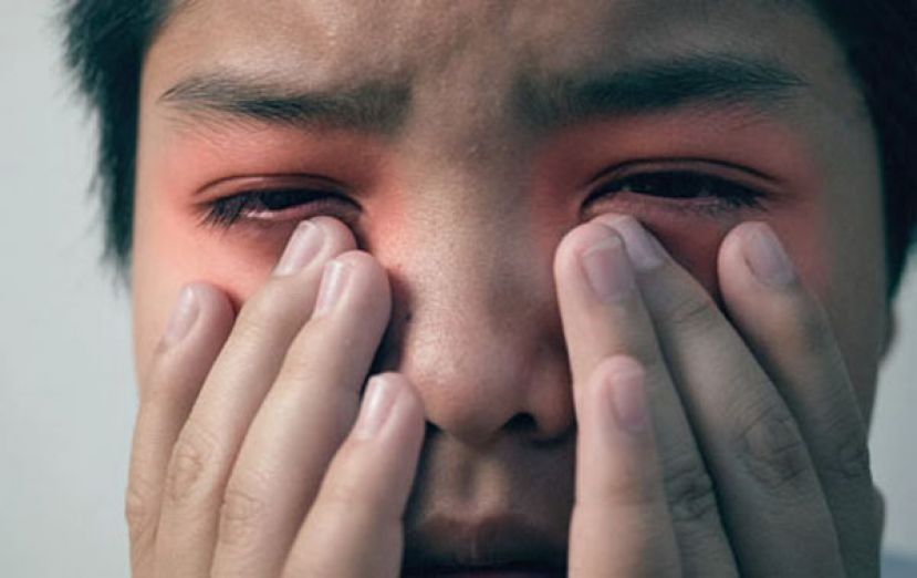 全身肿痛竟非蕁麻疹？  医揭罕见 &ldquo;河豚病&rdquo; 3大特点