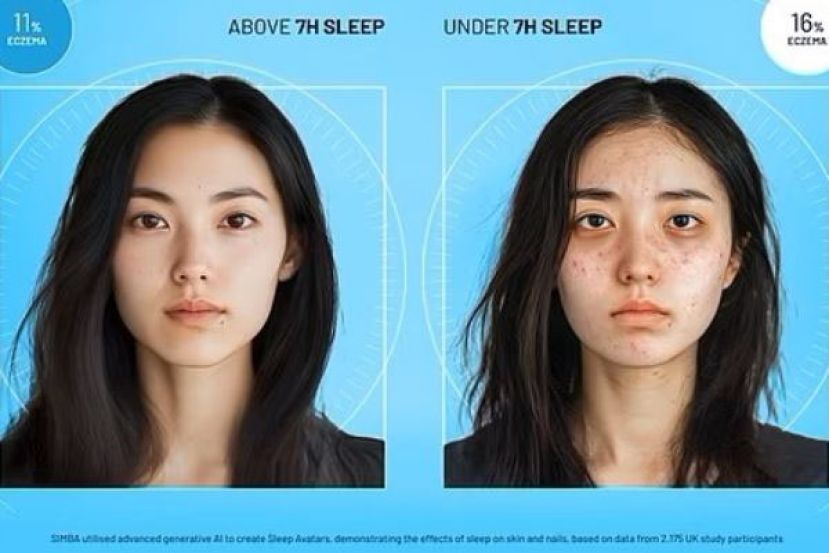 睡眠不足影响最先反映在皮肤上。