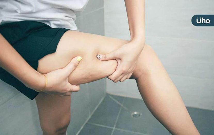 高强度运动小心横纹肌溶解症　医警告严重恐急性肾损伤