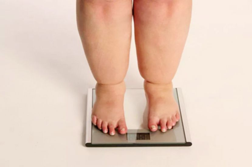 研究：重度肥胖者的早亡风险比正常人高50%