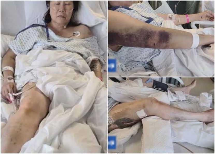 温迪身体多处受伤。