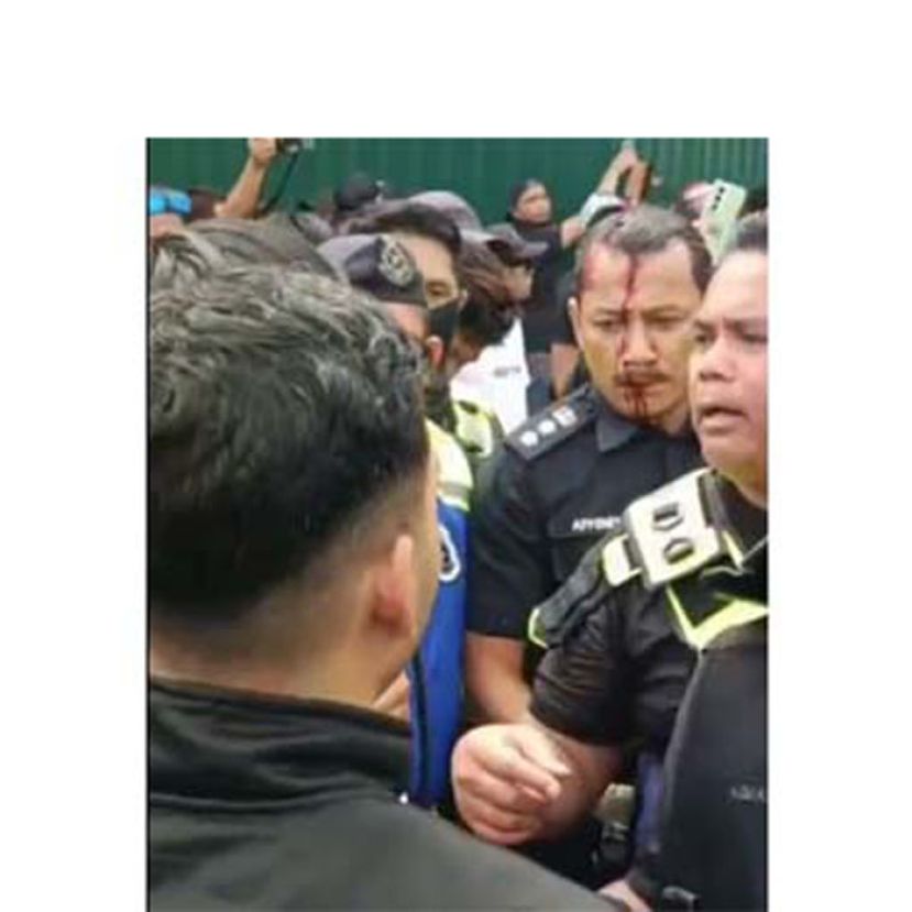 被袭击的金马警区主任苏里兹米阿芬迪助理总监头破血流。