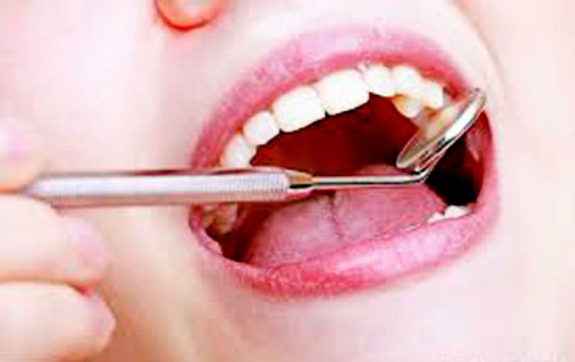 口腔有白斑、红斑 小心口腔癌悄上身