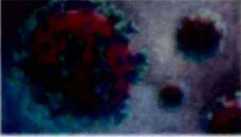 《新冠肺炎》  大马新增1307确诊5病逝