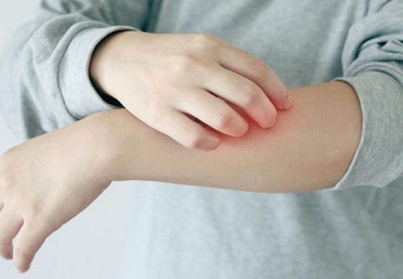 吃感冒药身体长斑纹？小心 &ldquo;固定型药物疹&rdquo;