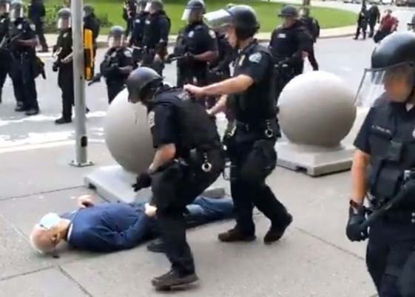 古吉诺后脑着地及流血。