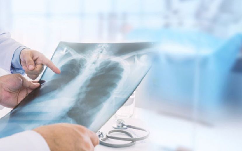 肺癌脑转移昏迷  肺癌标靶治疗后清醒