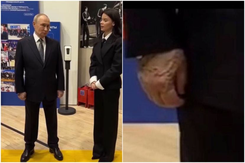 普京右手手背血管明显突起。