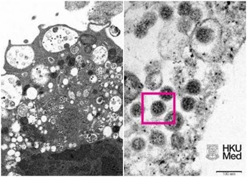 港大发布Omicron在显微镜下的真实面貌图片。