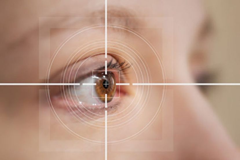 为什么名人网红都爱做？你所不知的 &ldquo;近视雷射&rdquo; 大哉问