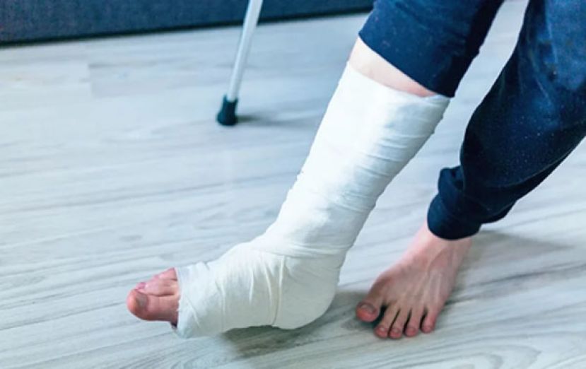 骨折吃什么才能加速骨头修复？　医：除了补钙蛋白质别忽略 &ldquo;它&rdquo;