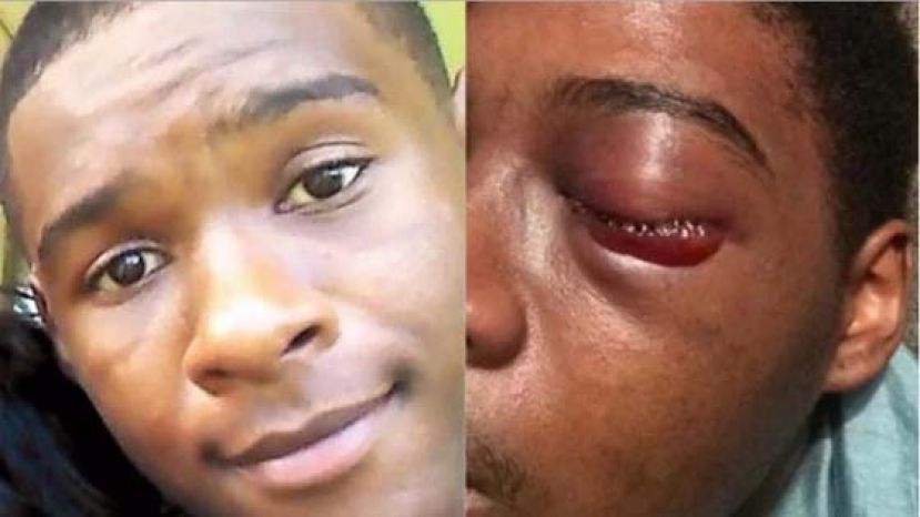 米勒被打爆眼睛前后的照片。