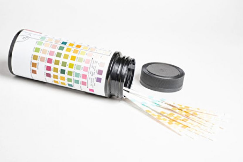 血尿这些症状暗示何疾病？