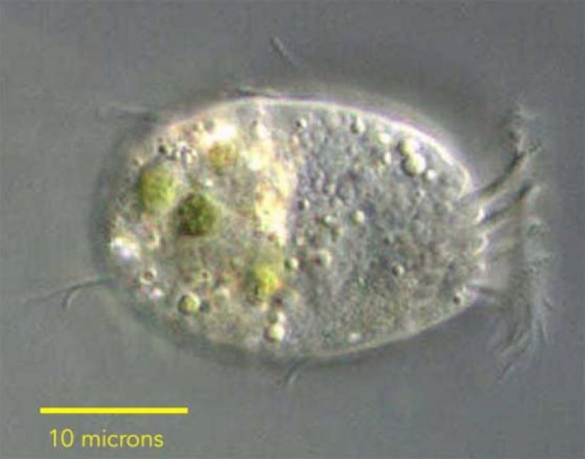 世界首次发现 一种专吃病毒的浮游生物