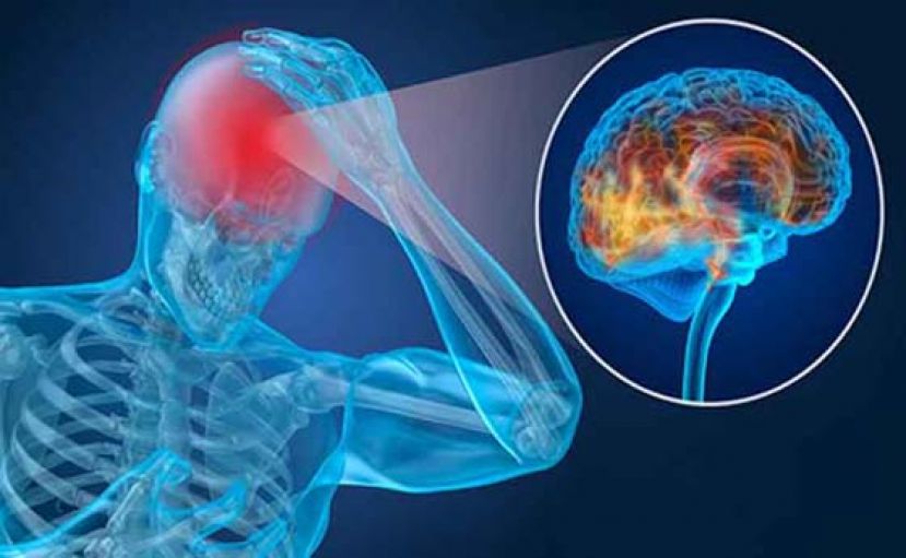 轻熟女3个月暴肥16公斤　6公分脑瘤作祟