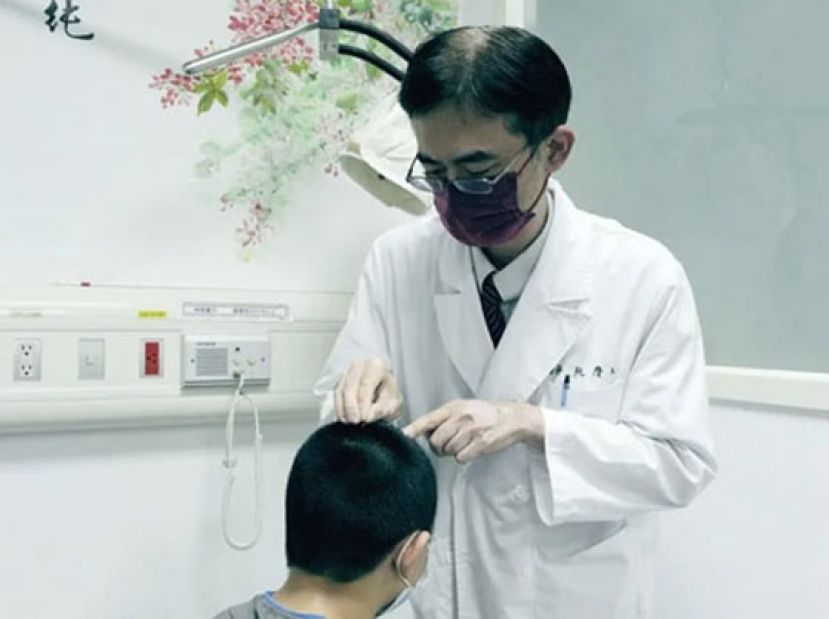 中医针灸百会穴、四神聪穴位　有效缓解妥瑞儿躁动