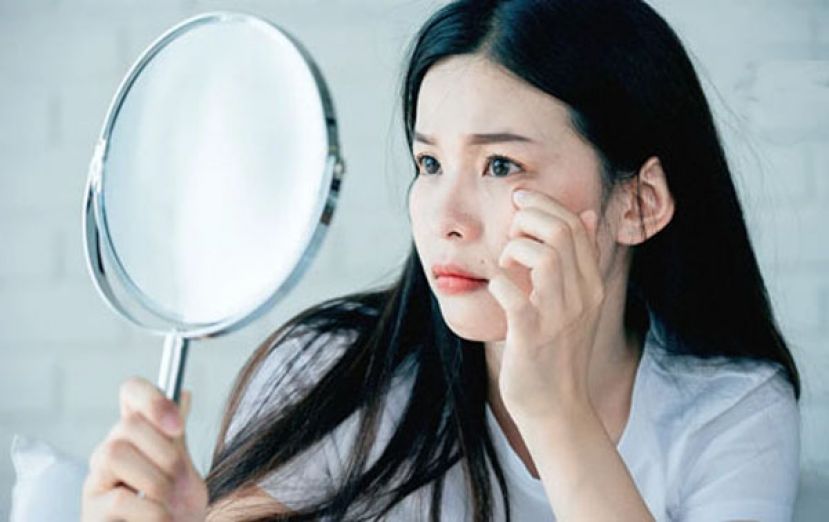 医警告这4种黑痣最好手术去除