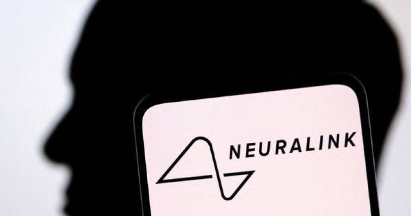 特斯拉创办人马斯克旗下的Neuralink为首位人类患者植入大脑晶片。