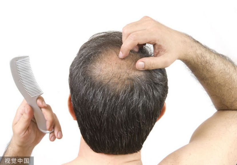 台湾大学的研究团队发现，只要涂抹含天然脂肪酸的精华液，就能在20天内促进毛发再生。