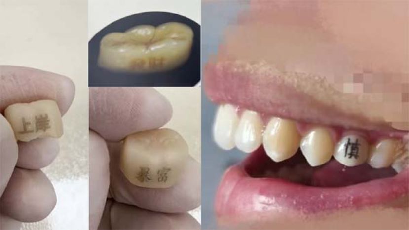 牙齿也能刻字？“发财”“上岸”最受欢迎。